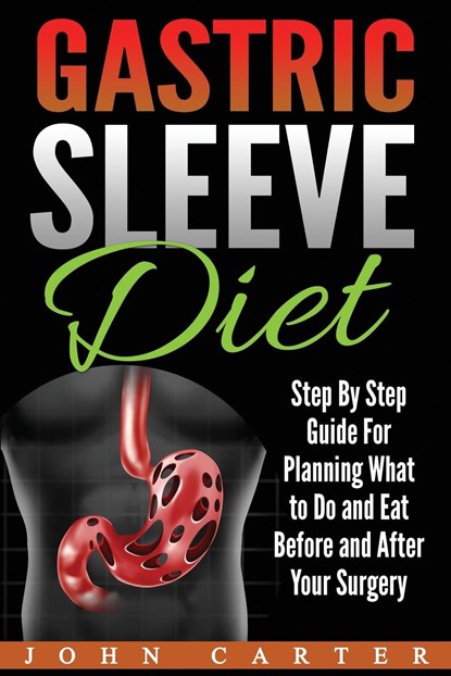 Gastric Sleeve Diet, John Carter - Paperback - 9781951103583