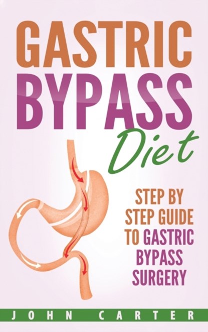 Gastric Bypass Diet, John Carter - Gebonden - 9781951404376
