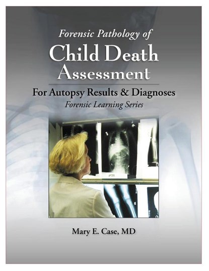 Forensic Pathology of Child Death Assessment, Mary E. Case - Gebonden - 9781953119056