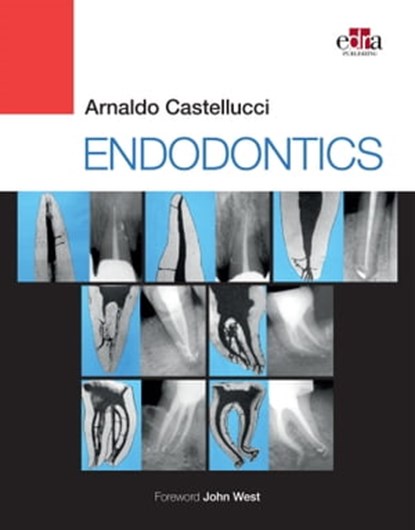Endodontics, Arnaldo Castellucci, MD - Ebook - 9781957260068