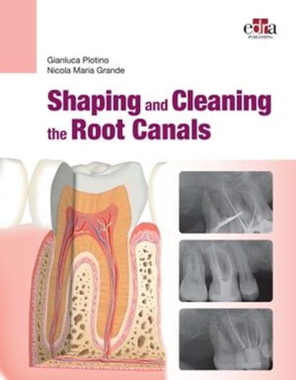 Shaping and Cleaning the Root Canals, Gianluca Plotino ; Nicola Maria Grande - Ebook - 9781957260372