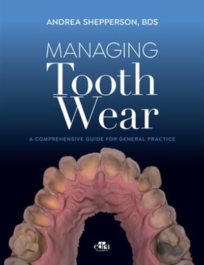 Managing Tooth Wear, Andrea Shepperson - Ebook - 9781957260594