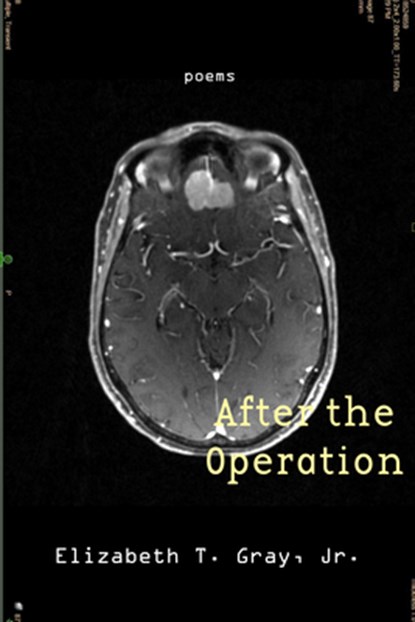 After the Operation, Elizabeth T. Gray - Paperback - 9781961897403