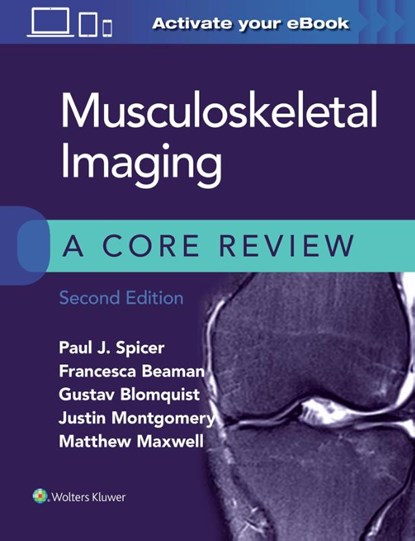 Musculoskeletal Imaging: A Core Review, Paul Spicer ; Francesca Beaman ; Gustav Blomquist ; Justin Montgomery - Paperback - 9781975120450