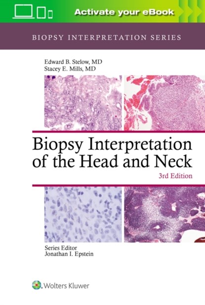 Biopsy Interpretation of the Head and Neck, Edward B. Stelow ; Stacey Mills - Gebonden - 9781975139360
