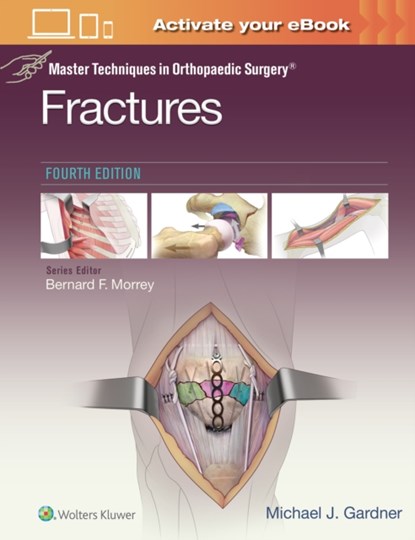 Master Techniques in Orthopaedic Surgery: Fractures, Michael J. Gardner - Gebonden - 9781975139407