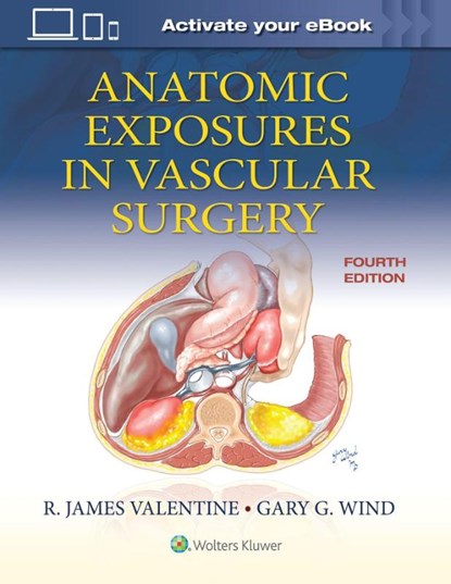 Anatomic Exposures in Vascular Surgery, R. James Valentine ; Gary G. Wind - Gebonden - 9781975152765