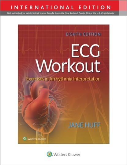 ECG Workout, Jane Huff - Paperback - 9781975174576