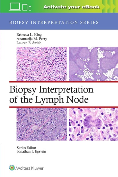 Biopsy Interpretation of the Lymph Node: Print + eBook with Multimedia, REBECCA LEIGH,  MD King ; Anamarija M., MD Perry ; Lauren B. Smith - Gebonden - 9781975184629