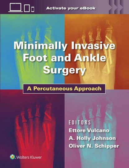 Minimally Invasive Foot and Ankle Surgery, Dr. Ettore Vulcano ; A. Holland Johnson ; Oliver Schipper - Gebonden - 9781975198701