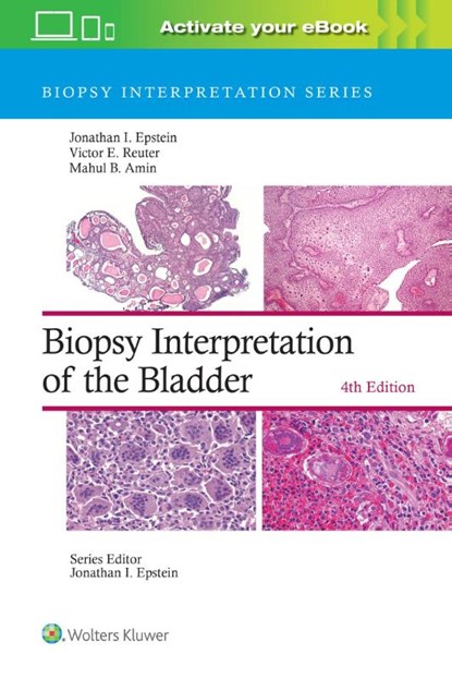 Biopsy Interpretation of the Bladder: Print + eBook with Multimedia, Jonathan I. Epstein ; Victor E. Reuter ; Mahul B. Amin - Gebonden - 9781975199203