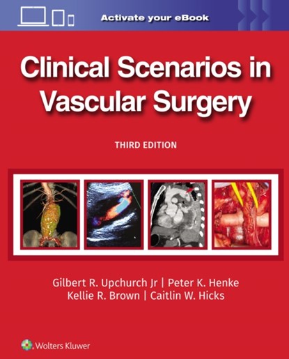 Clinical Scenarios in Vascular Surgery, GILBERT R. UPCHURCH ; PETER HENKE ; Kellie R. Brown ; Caitlin Whitney Hicks - Gebonden - 9781975216238