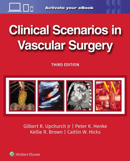Clinical Scenarios in Vascular Surgery, GILBERT R. UPCHURCH ; PETER HENKE ; Kellie R. Brown ; Caitlin Whitney Hicks - Gebonden - 9781975216238