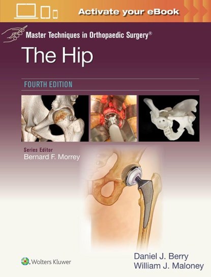 Master Techniques in Orthopaedic Surgery: The Hip: Print + eBook with Multimedia, DANIEL JOHN BERRY ; WILLIAM JOSEPH MALONEY - Gebonden - 9781975222000