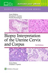 Biopsy Interpretation of the Uterine Cervix and Corpus: Print + eBook with Multimedia - ANAIS MALPICA ; ELIZABETH D. EUSCHER ; Preetha Ramalingam - 9781975236786