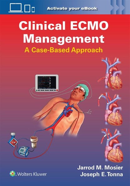 Clinical ECMO Management, Jarrod Mosier ; Joseph Edward Tonna - Paperback - 9781975240141