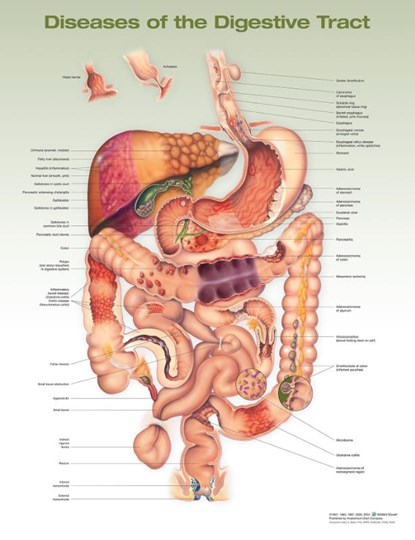 Diseases of the Digestive Tract Anatomical Chart, Anatomical Chart Company - Gebonden - 9781975243258