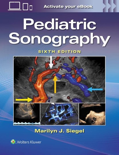 Pediatric Sonography, MARILYN JOY SIEGEL - Paperback - 9781975248239