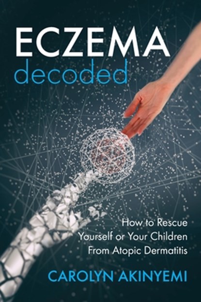 Eczema Decoded: How to Rescue Yourself or Your Children from Atopic Dermatitis, Carolyn Akinyemi - Paperback - 9781999699635