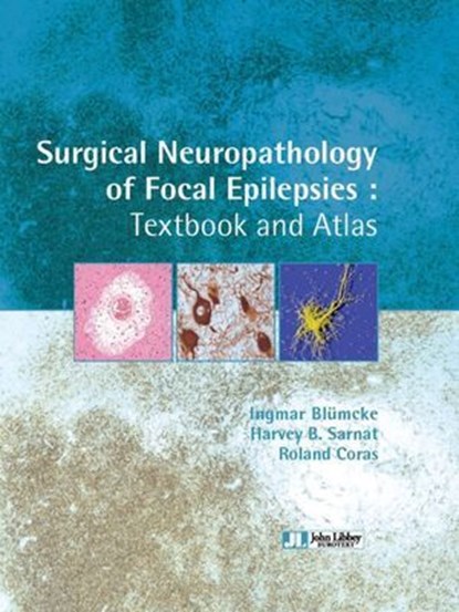 Surgical Neuropathology of Focal Epilepsies, Ingmar Blümcke ; Harvey B. Sarnat ; Roland Coras - Ebook - 9782742014514