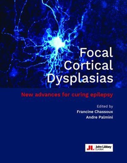 Focal Cortical Dysplasias, Francine Chassoux ; Andre Palmini - Ebook - 9782742017294