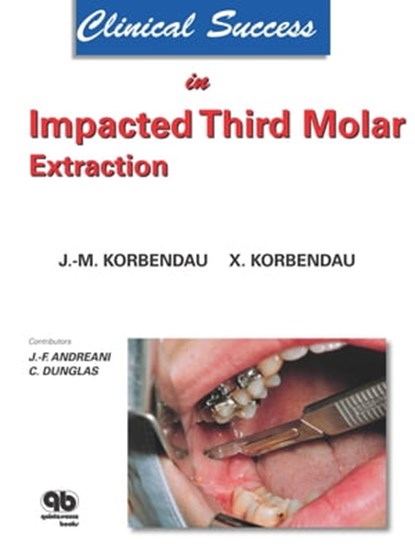 Clinical Success in Impacted Third Molar Extraction, Jean-Marie Korbendau ; Xavier Korbendau - Ebook - 9782912550811