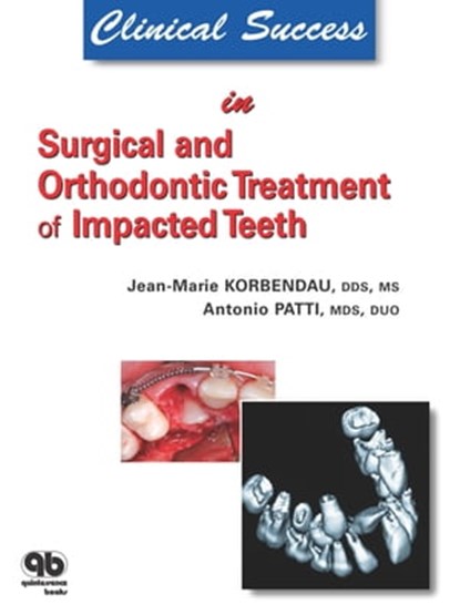 Clinical Success in Surgical and Orthodontic Treatment of Impacted Teeth, Jean-Marie Korbendau ; Antonio Patti - Ebook - 9782912550859