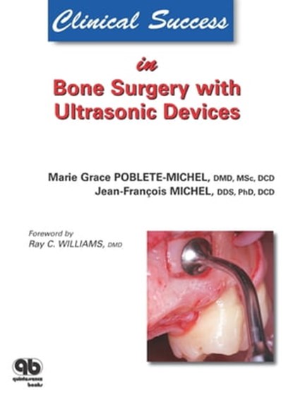 Clinical Success in Bone Surgery with Ultrasonic Devices, Marie G. Poblete-Michel ; Jean-Franҫois Michel - Ebook - 9782912550873