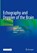 Echography and Doppler of the Brain, Chiara Robba ; Giuseppe Citerio - Gebonden - 9783030482015