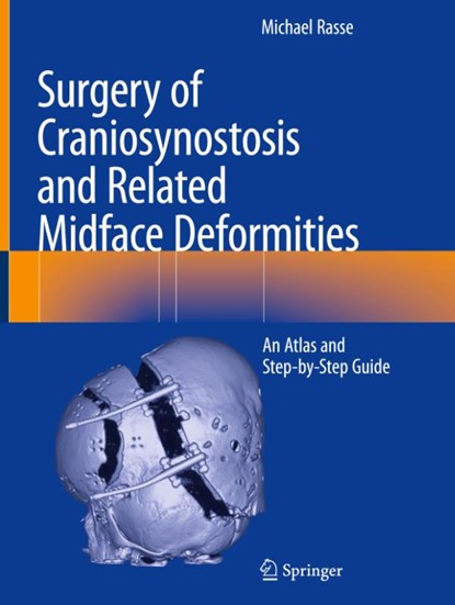 Surgery of Craniosynostosis and Related Midface Deformities, Michael Rasse - Gebonden - 9783031491016