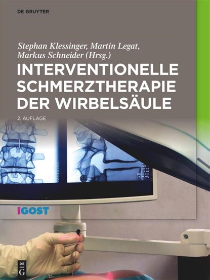 Interventionelle Schmerztherapie der Wirbelsäule, Stephan Klessinger ; Martin Legat ; Markus Schneider - Gebonden - 9783111168609