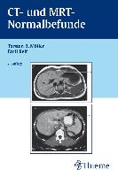 CT und MRT Normalbefunde, MÖLLER,  Torsten Bert ; Reif, Emil - Paperback - 9783131124227