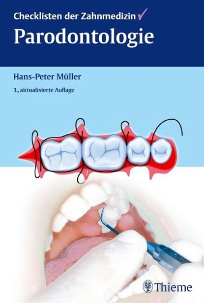 Checklisten der Zahnmedizin Parodontologie, Hans-Peter Müller - Gebonden - 9783131263636