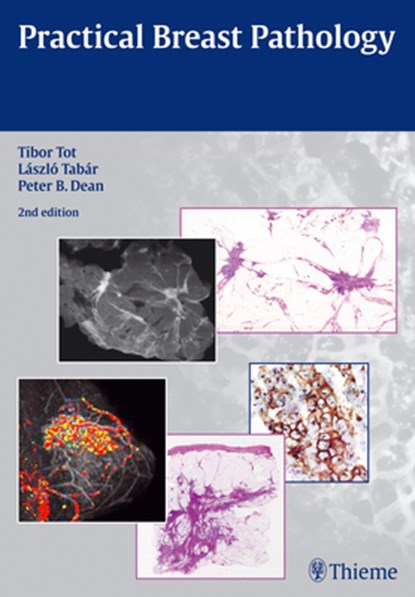 Practical Breast Pathology, Tibor Tot ; Laszlo Tabar ; Peter B. Dean - Gebonden - 9783131294326