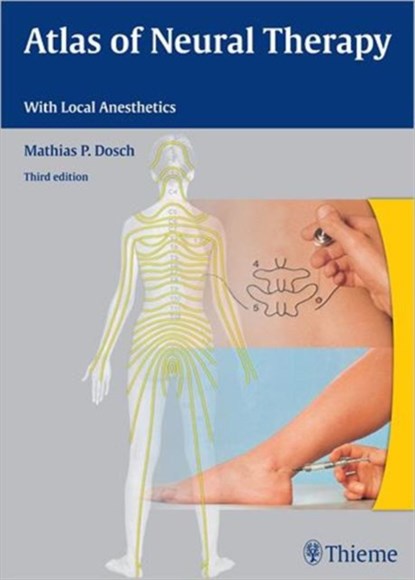 Atlas of Neural Therapy, Mathias Dosch - Gebonden - 9783131305732