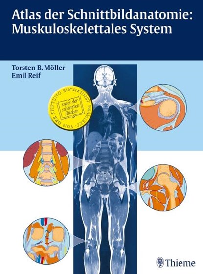 Atlas der Schnittbildanatomie: Muskuloskelettales System, Torsten Bert Möller ; Emil Reif - Gebonden - 9783131417718