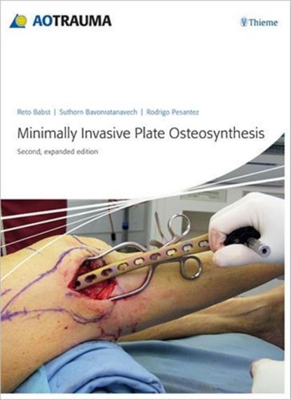 Minimally Invasive Plate Ostheosynthesis, Reto Babst ; Suthorn Bavonratanavech ; Rodrigo F. Pesantez - Gebonden - 9783131433923