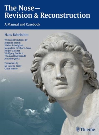 The Nose - Revision and Reconstruction, Hans Behrbohm ; Jacqueline Eichhorn-Sens ; Joachim Ulrich Quetz - Gebonden - 9783131435910