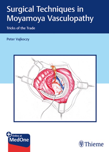 Surgical Techniques in Moyamoya Vasculopathy, Peter Vajkoczy - Gebonden - 9783131450616