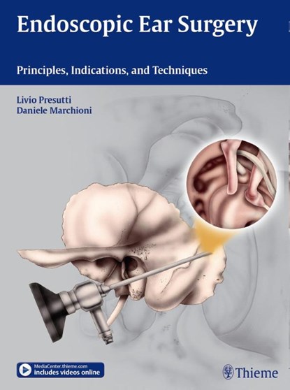 Endoscopic Ear Surgery, Livio Presutti ; Daniele Marchioni - Gebonden - 9783131630414