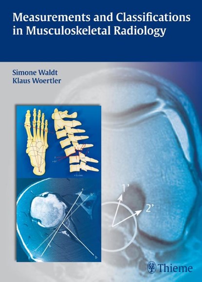 Measurements and Classifications in Musculoskeletal Radiology, Simone Waldt ; Klaus Wortler - Gebonden - 9783131692719