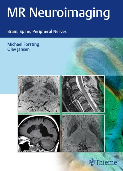 MR Neuroimaging, Michael Forsting ; Olav Jansen - Gebonden - 9783132026810