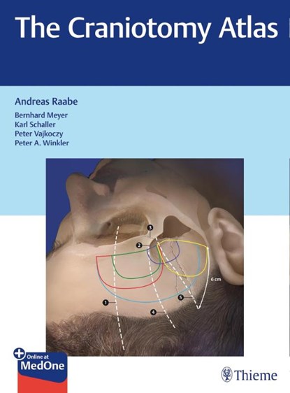 The Craniotomy Atlas, Andreas Raabe - Gebonden - 9783132057913