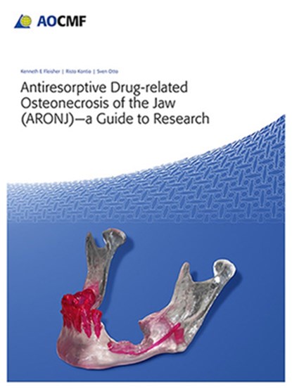 Antiresorptive Drug-Related Osteonecrosis of the Jaw (ARONJ) - a Guide to Research, Kenneth Fleisher ; Risto Kontio ; Sven Otto - Paperback - 9783132412705