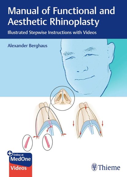 Manual of Functional and Aesthetic Rhinoplasty, Alexander Berghaus - Gebonden - 9783132412781