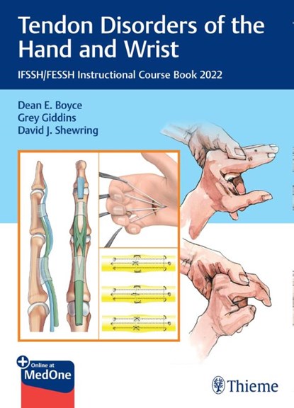Tendon Disorders of the Hand and Wrist, BOYCE,  Dean E. ; Giddins, Grey ; Shewring, David J. - Gebonden - 9783132442214