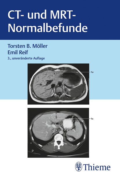 CT und MRT Normalbefunde, Torsten Bert Möller ; Emil Reif - Paperback - 9783132453074