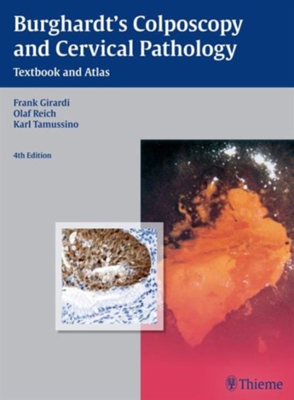 Burghardt's Colposcopy and Cervical Pathology, Erich Burghardt ; Frank Girardi ; Olaf Reich ; Karl Tamussino ; Hellmuth Pickel - Gebonden - 9783136599044