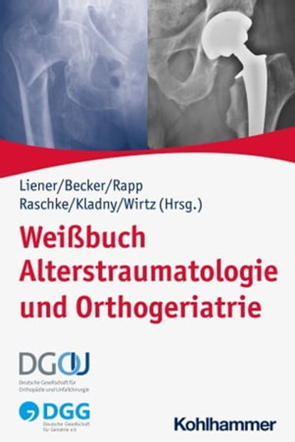 Weißbuch Alterstraumatologie und Orthogeriatrie, Rene Aigner ; Philip Anderson ; Christine von Arnim ; Gabriele Bales ; Christoph Bartl ; Christopher Bliemel ; Wolfgang Böcker ; Cornelius Bollheimer ; Hartmut Bork ; Benjamin Bücking ; Kerstin Bühl ; Heinrich Burkhardt ; Mark Coburn ; Michael Denkinger ; - Ebook - 9783170411760