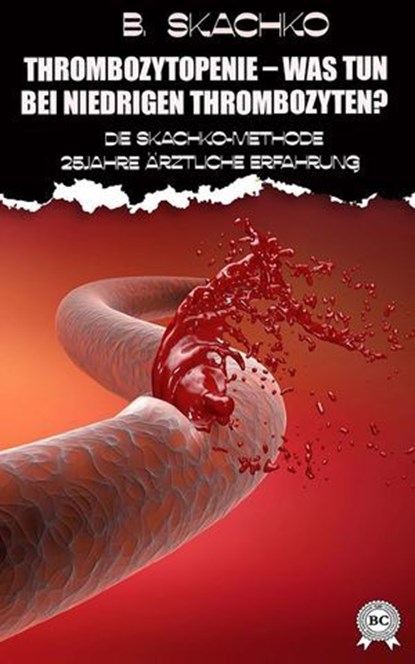 Thrombozytopenie – was tun bei niedrigen Thrombozyten?, B. Skachko - Ebook - 9783200000995